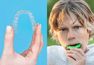 What’s the Difference Between a Night Guard and a Sports Mouthguard? The Answer Could Save Your Teeth